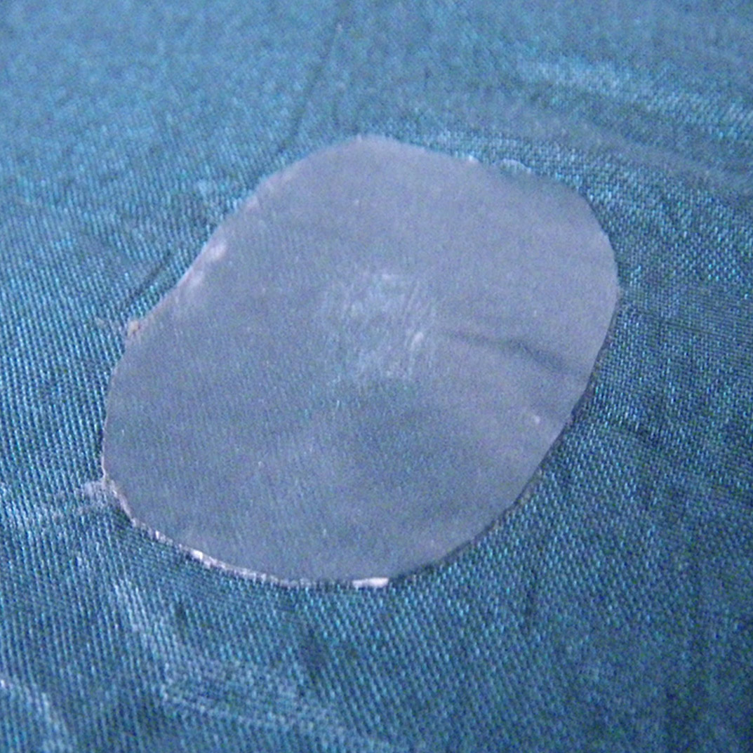 Hammock Repair Kit - Image 2